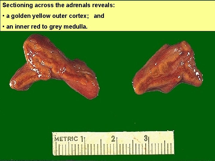 Sectioning across the adrenals reveals: • a golden yellow outer cortex; and • an