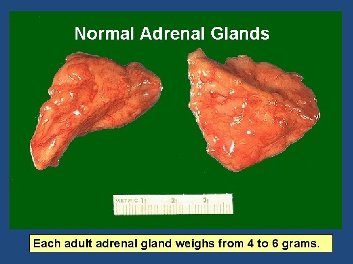 Normal Adrenal Glands Each adult adrenal gland weighs from 4 to 6 grams. 