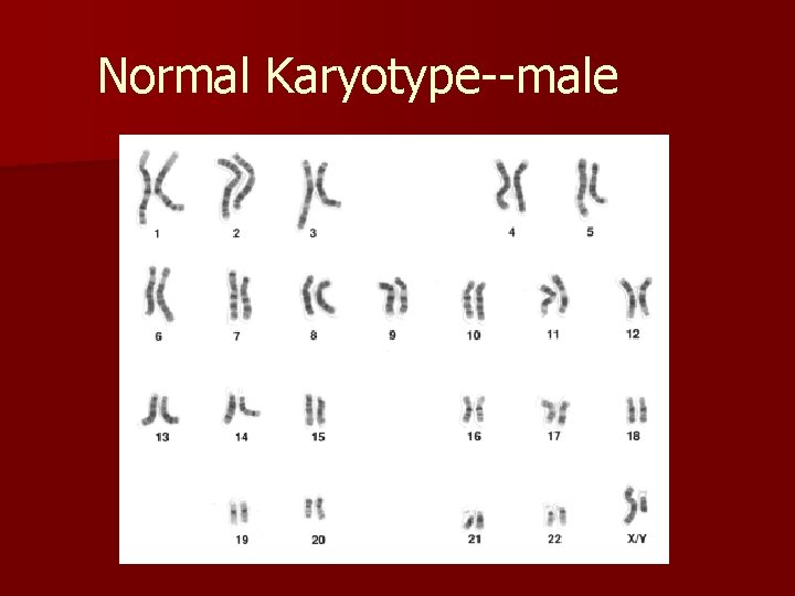 Normal Karyotype--male 