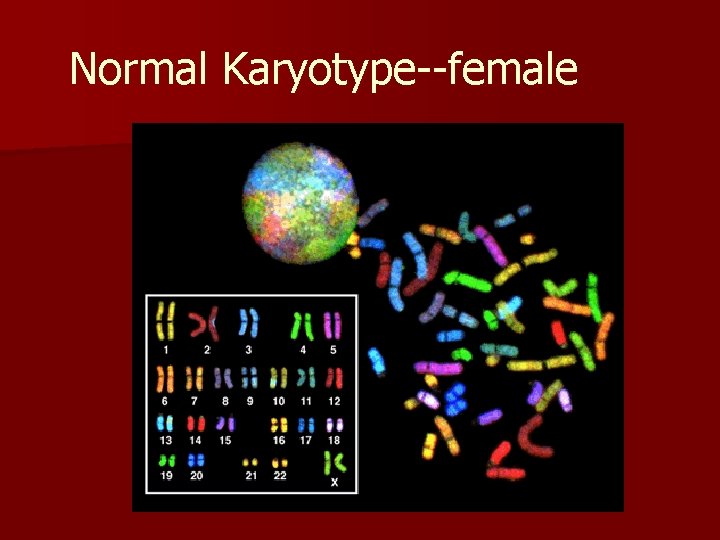 Normal Karyotype--female 