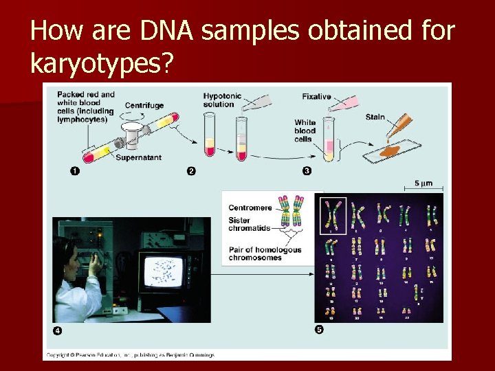 How are DNA samples obtained for karyotypes? 