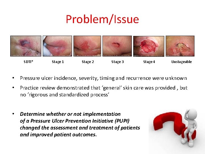Problem/Issue SDTI* Stage 1 Stage 2 Stage 3 Stage 4 Unstageable • Pressure ulcer