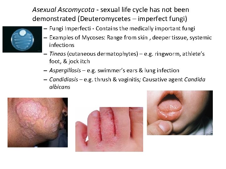 Asexual Ascomycota - sexual life cycle has not been demonstrated (Deuteromycetes – imperfect fungi)