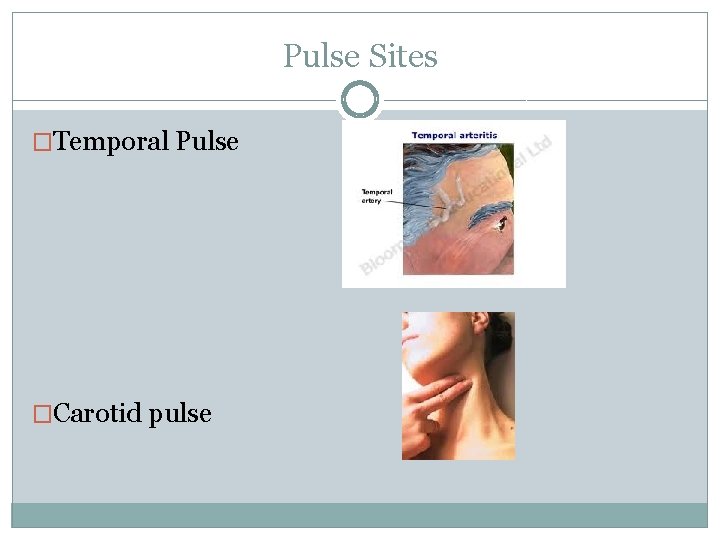 Pulse Sites �Temporal Pulse �Carotid pulse 