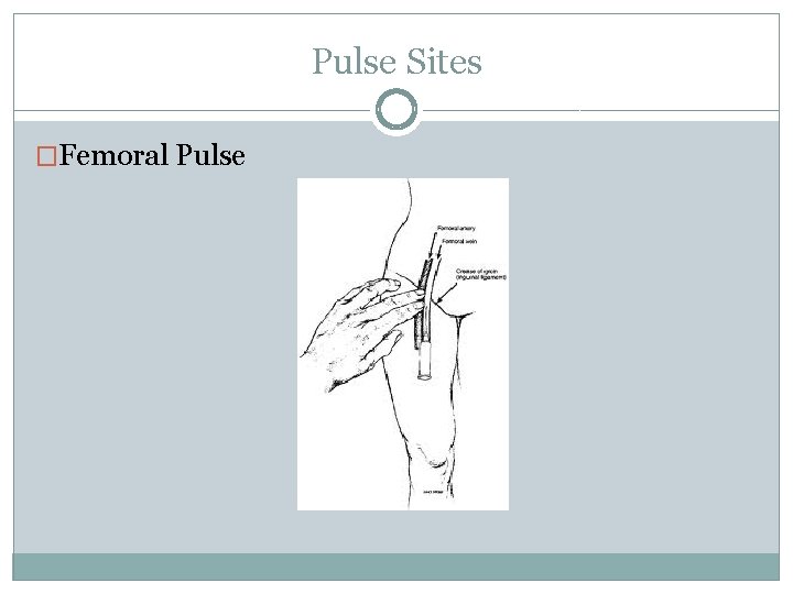 Pulse Sites �Femoral Pulse Pulse Sites �Femoral Pulse