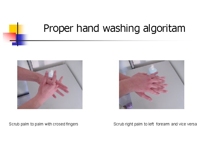 Proper hand washing algoritam Scrub palm to palm with crosed fingers Scrub right palm