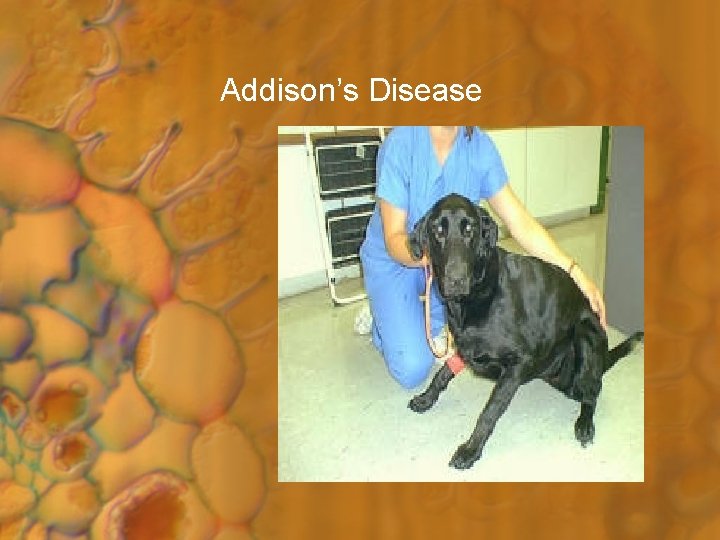Addison’s Disease 