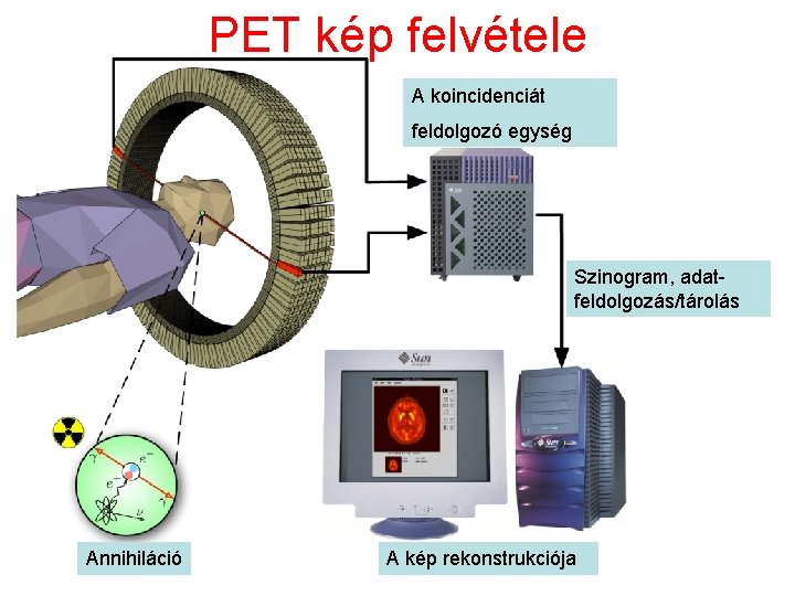 PET kép felvétele A koincidenciát feldolgozó egység Szinogram, adatfeldolgozás/tárolás Annihiláció A kép rekonstrukciója 