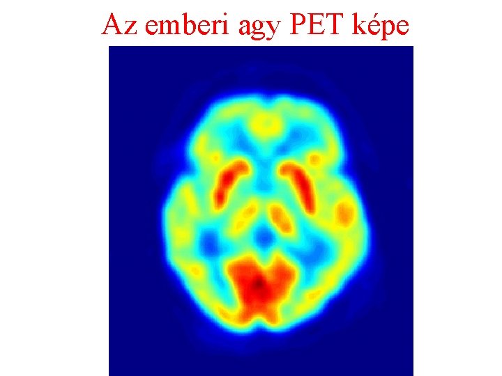 Az emberi agy PET képe 