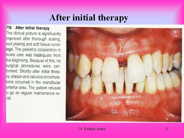 After initial therapy Dr. Kadhim Jawad 25 