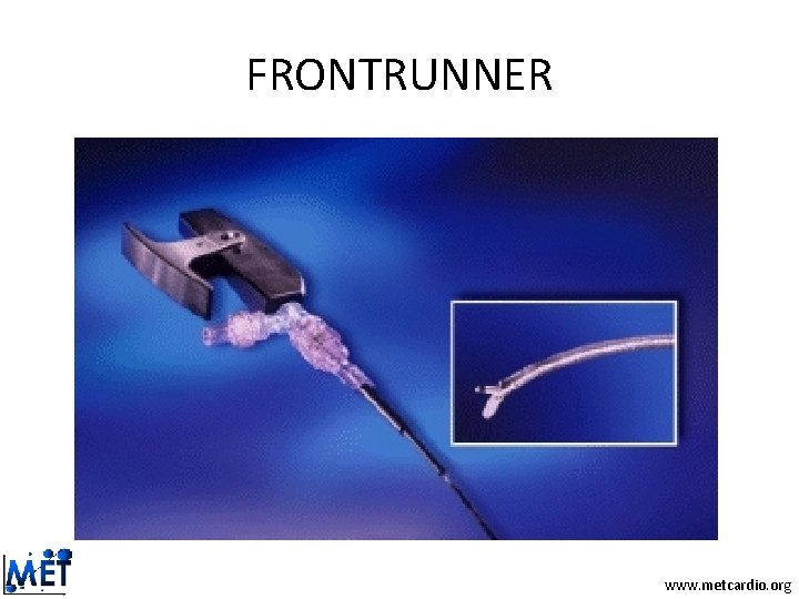FRONTRUNNER www. metcardio. org FRONTRUNNER www. metcardio. org