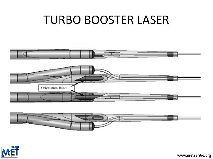TURBO BOOSTER LASER www. metcardio. org TURBO BOOSTER LASER www. metcardio. org