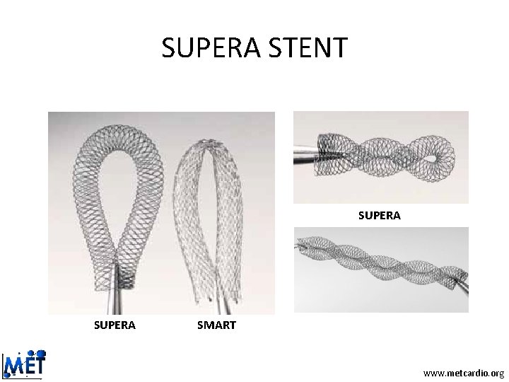 SUPERA STENT SUPERA SMART www. metcardio. org SUPERA STENT SUPERA SMART www. metcardio. org