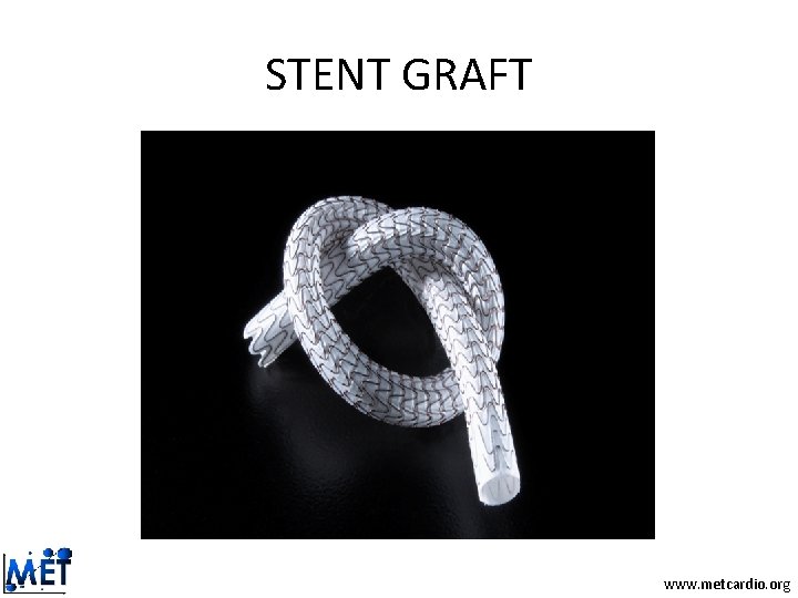 STENT GRAFT www. metcardio. org STENT GRAFT www. metcardio. org