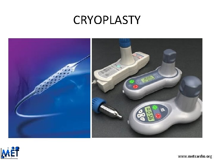CRYOPLASTY www. metcardio. org CRYOPLASTY www. metcardio. org