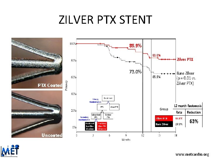 ZILVER PTX STENT www. metcardio. org ZILVER PTX STENT www. metcardio. org