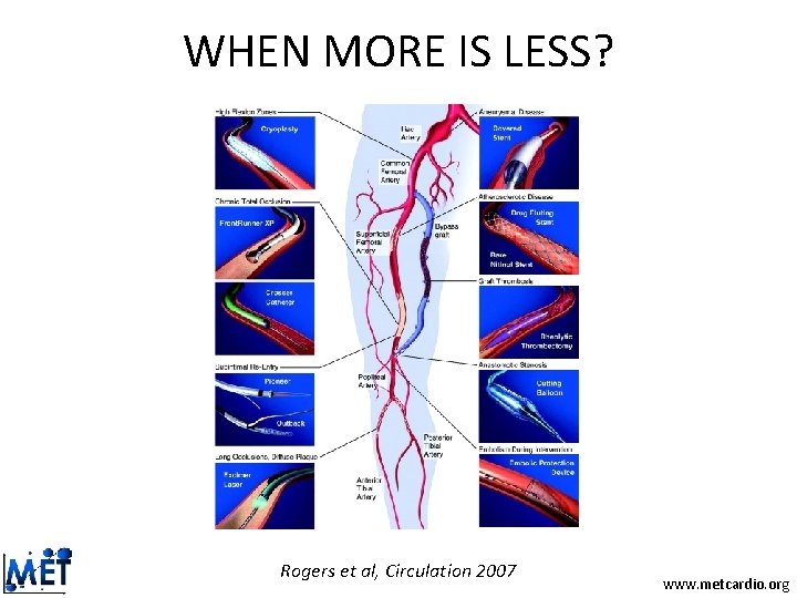 WHEN MORE IS LESS? Rogers et al, Circulation 2007 www. metcardio. org WHEN MORE IS LESS? Rogers et al, Circulation 2007 www. metcardio. org
