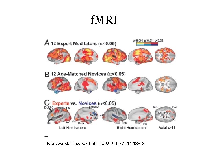 f. MRI Brefczynski-Lewis, et al. 2007104(27): 11483 -8 