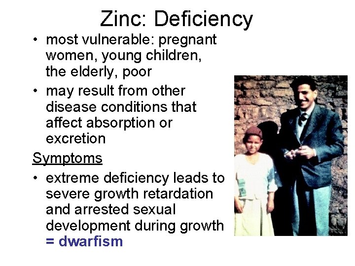 Zinc: Deficiency • most vulnerable: pregnant women, young children, the elderly, poor • may Zinc: Deficiency • most vulnerable: pregnant women, young children, the elderly, poor • may