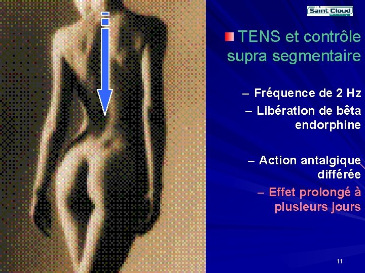 TENS et contrôle supra segmentaire – Fréquence de 2 Hz – Libération de bêta TENS et contrôle supra segmentaire – Fréquence de 2 Hz – Libération de bêta