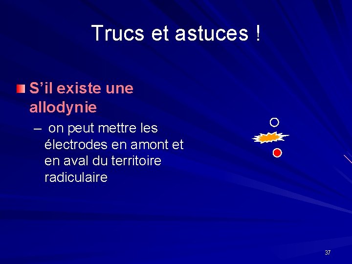 Trucs et astuces ! S’il existe une allodynie – on peut mettre les électrodes Trucs et astuces ! S’il existe une allodynie – on peut mettre les électrodes