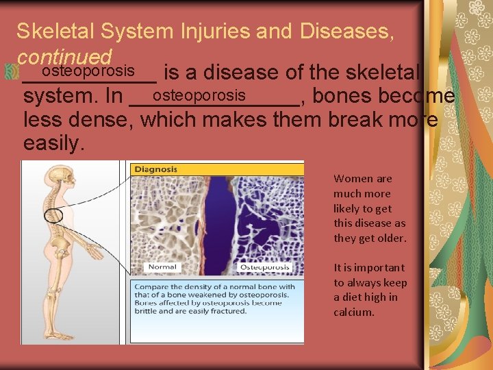 Skeletal System Injuries and Diseases, continued osteoporosis ______ is a disease of the skeletal