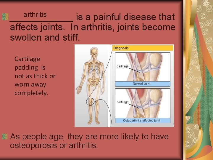 arthritis ______ is a painful disease that affects joints. In arthritis, joints become swollen