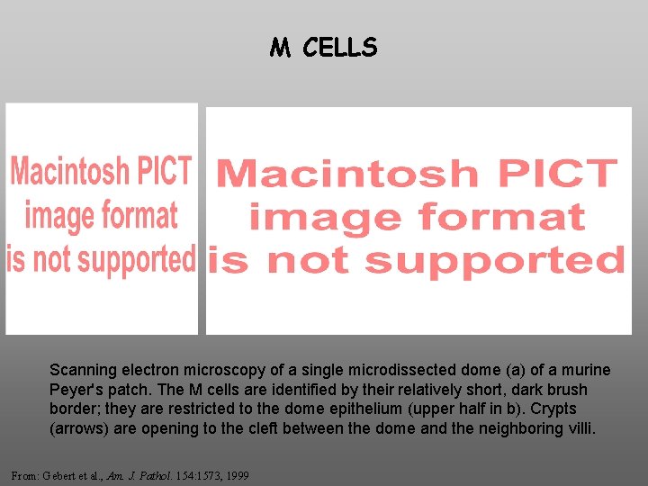 M CELLS Scanning electron microscopy of a single microdissected dome (a) of a murine
