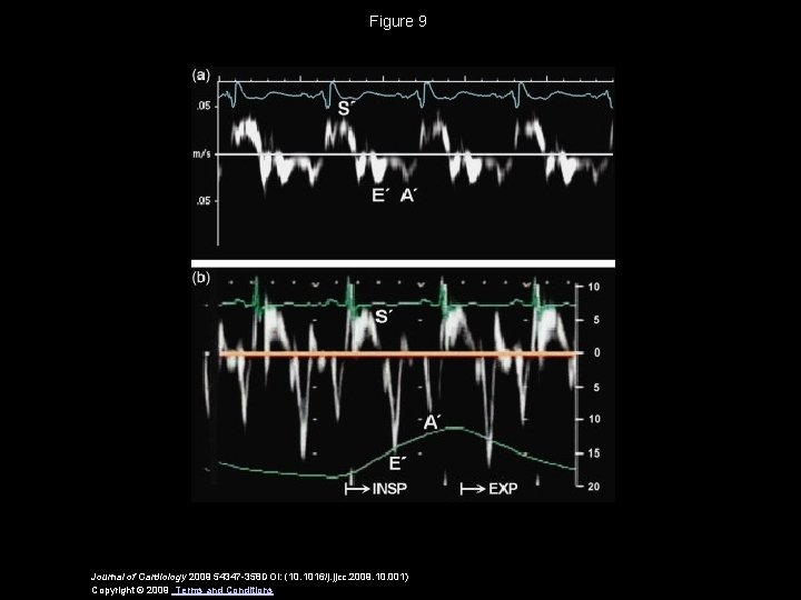 Figure 9 Journal of Cardiology 2009 54347 -358 DOI: (10. 1016/j. jjcc. 2009. 10.