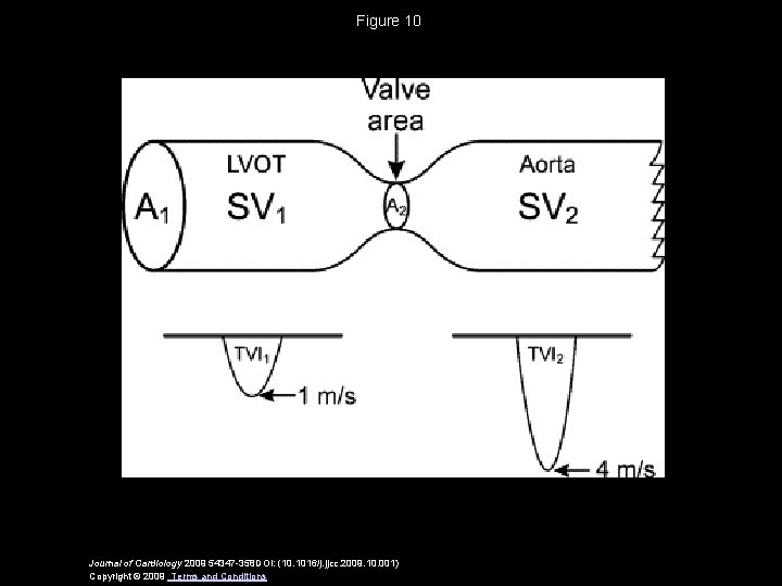 Figure 10 Journal of Cardiology 2009 54347 -358 DOI: (10. 1016/j. jjcc. 2009. 10.
