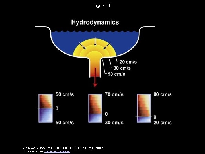 Figure 11 Journal of Cardiology 2009 54347 -358 DOI: (10. 1016/j. jjcc. 2009. 10.