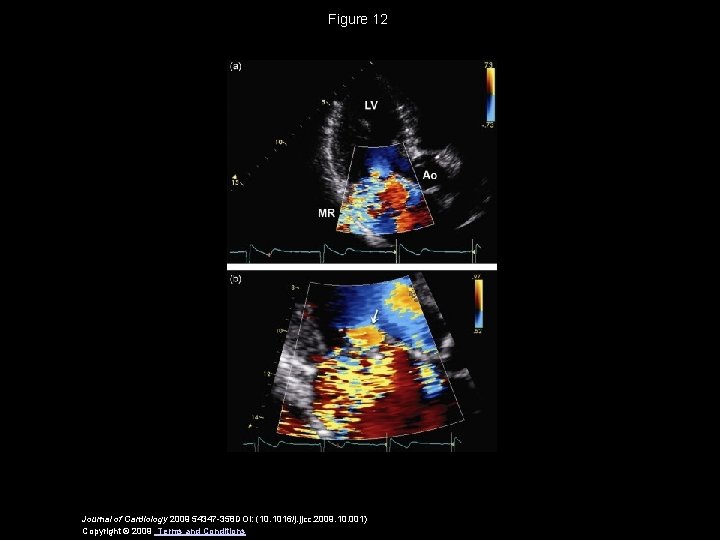 Figure 12 Journal of Cardiology 2009 54347 -358 DOI: (10. 1016/j. jjcc. 2009. 10.