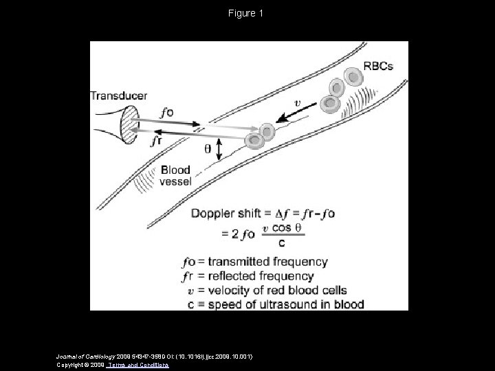 Figure 1 Journal of Cardiology 2009 54347 -358 DOI: (10. 1016/j. jjcc. 2009. 10.