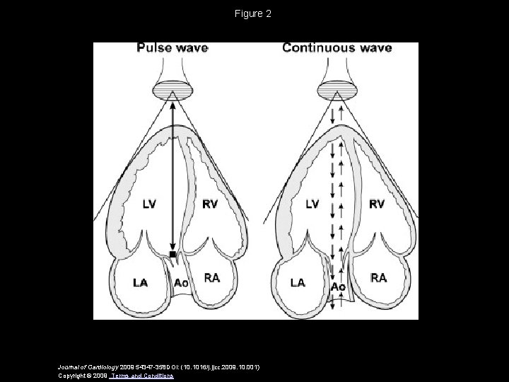 Figure 2 Journal of Cardiology 2009 54347 -358 DOI: (10. 1016/j. jjcc. 2009. 10.