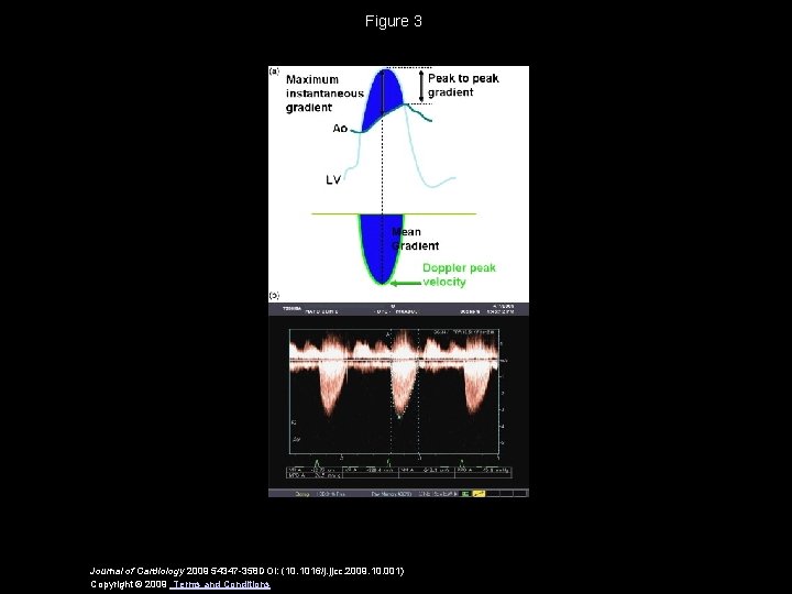 Figure 3 Journal of Cardiology 2009 54347 -358 DOI: (10. 1016/j. jjcc. 2009. 10.