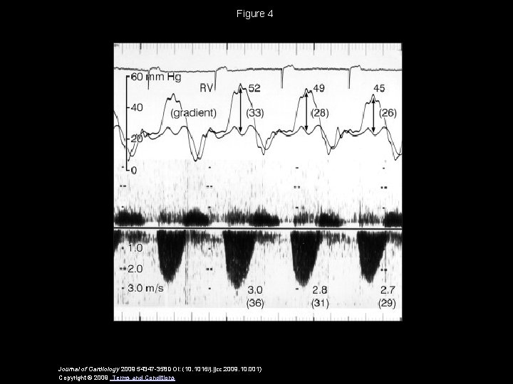 Figure 4 Journal of Cardiology 2009 54347 -358 DOI: (10. 1016/j. jjcc. 2009. 10.