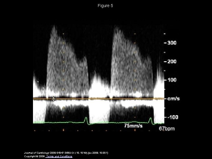 Figure 5 Journal of Cardiology 2009 54347 -358 DOI: (10. 1016/j. jjcc. 2009. 10.