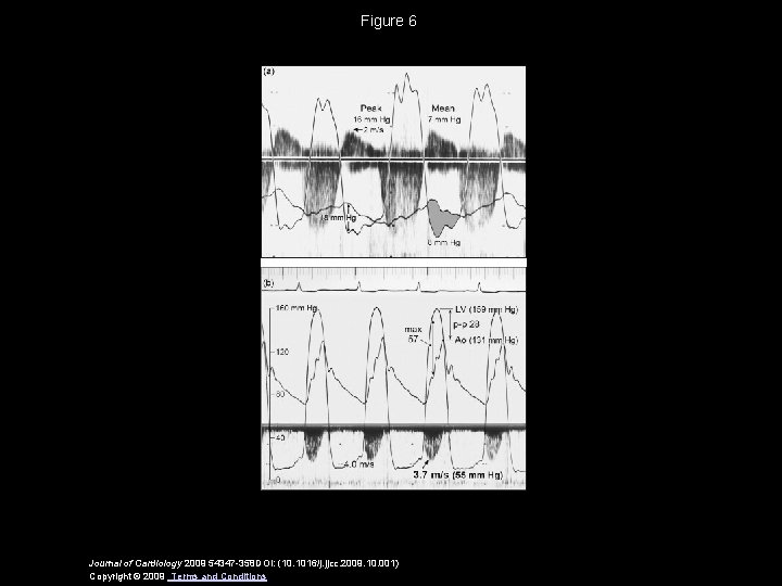 Figure 6 Journal of Cardiology 2009 54347 -358 DOI: (10. 1016/j. jjcc. 2009. 10.