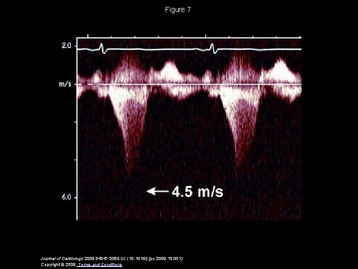 Figure 7 Journal of Cardiology 2009 54347 -358 DOI: (10. 1016/j. jjcc. 2009. 10.