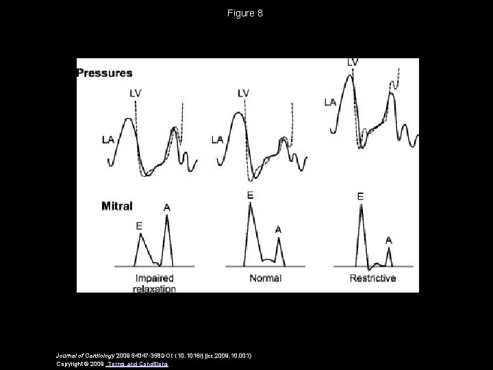 Figure 8 Journal of Cardiology 2009 54347 -358 DOI: (10. 1016/j. jjcc. 2009. 10.