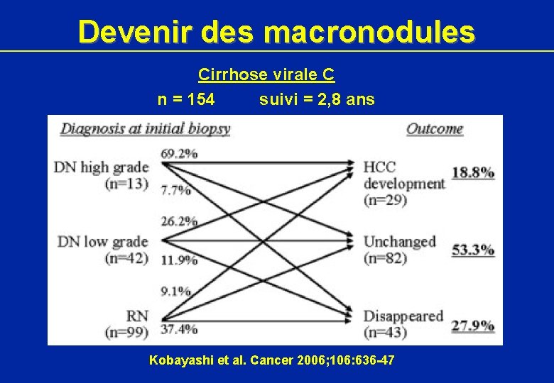 Devenir des macronodules Cirrhose virale C n = 154 suivi = 2, 8 ans Devenir des macronodules Cirrhose virale C n = 154 suivi = 2, 8 ans