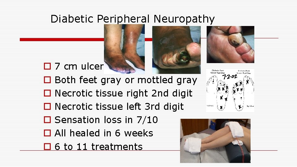 Diabetic Peripheral Neuropathy o o o o 7 cm ulcer Both feet gray or