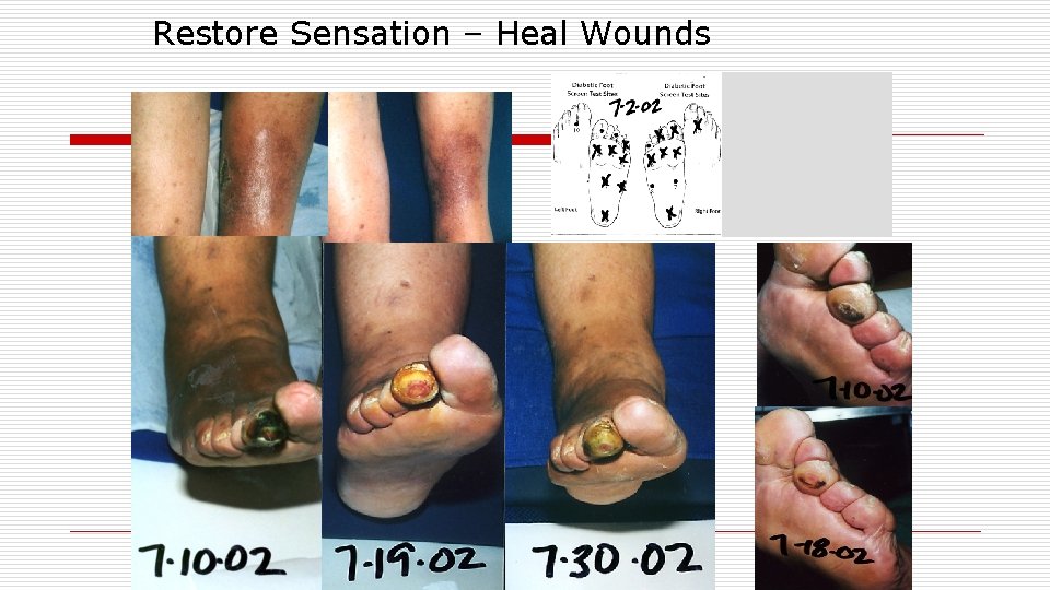 Restore Sensation – Heal Wounds 