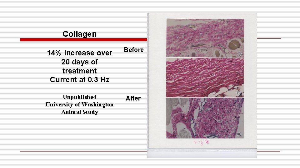 Collagen 14% increase over 20 days of treatment Current at 0. 3 Hz Before