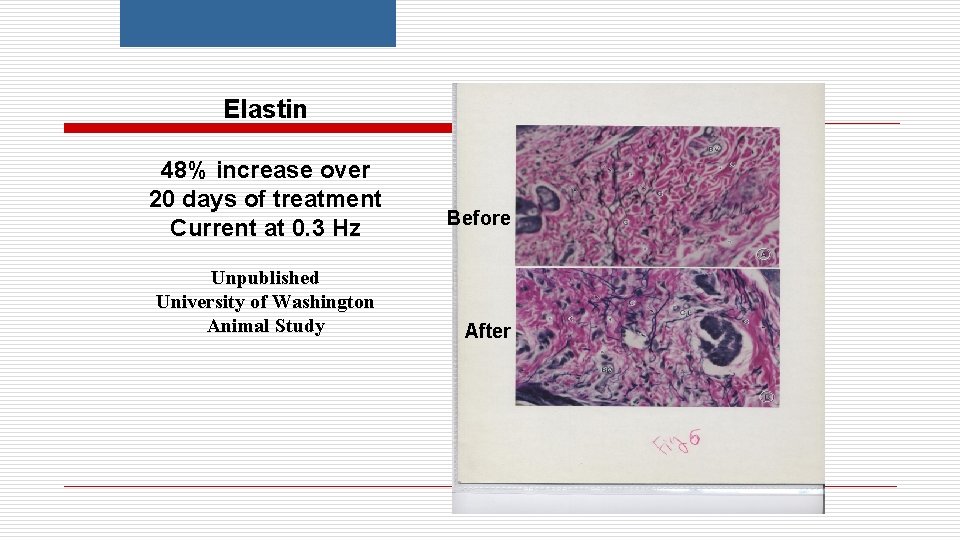 Elastin 48% increase over 20 days of treatment Current at 0. 3 Hz Unpublished