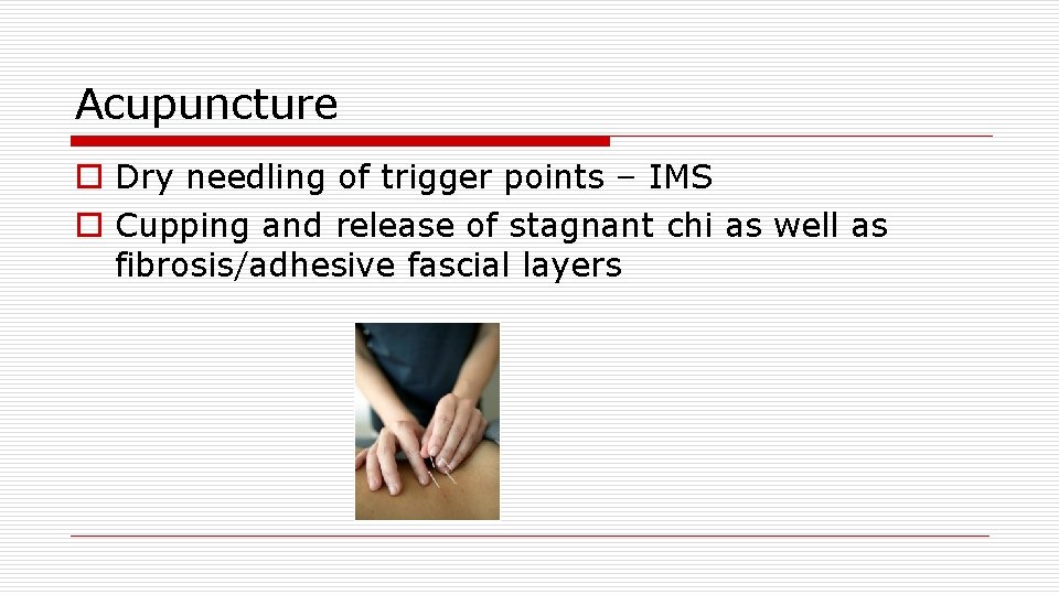 Acupuncture o Dry needling of trigger points – IMS o Cupping and release of