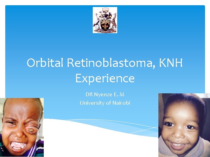 Orbital Retinoblastoma, KNH Experience DR Nyenze E. M University of Nairobi 