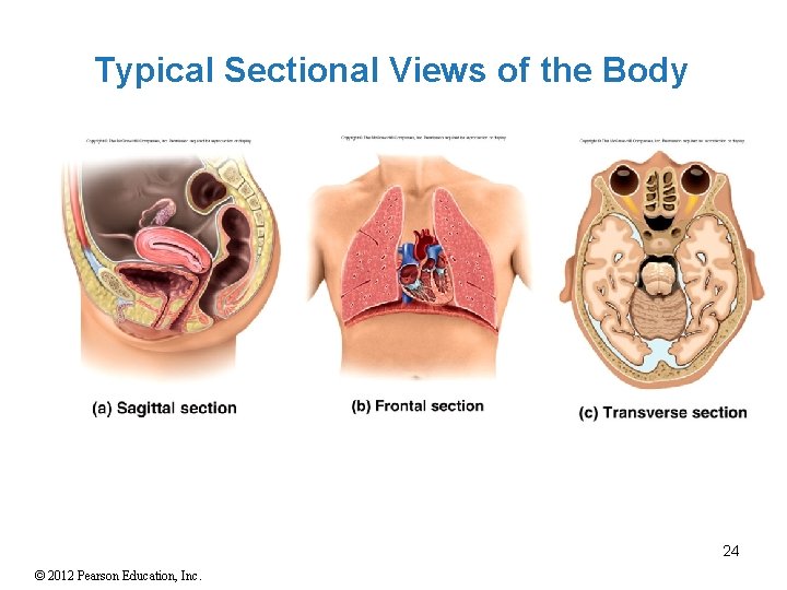 Typical Sectional Views of the Body 24 © 2012 Pearson Education, Inc. 