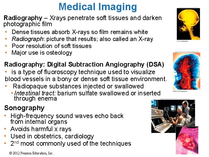 Medical Imaging Radiography – Xrays penetrate soft tissues and darken photographic film • Dense