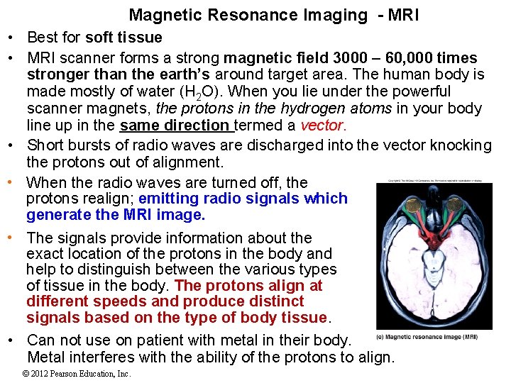 Magnetic Resonance Imaging - MRI • Best for soft tissue • MRI scanner forms